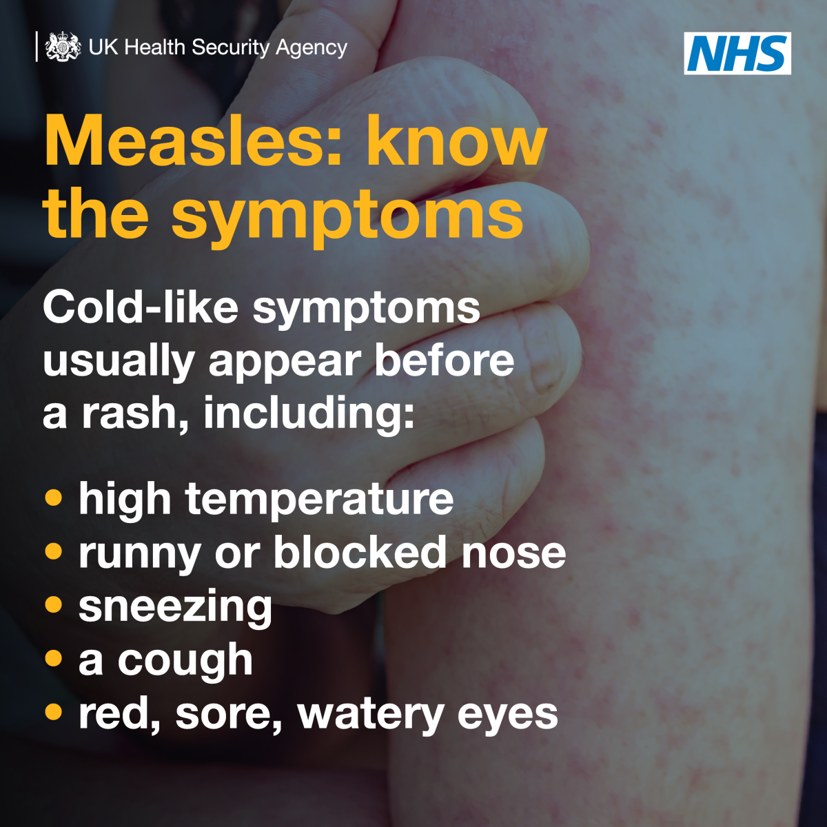 Derbyshire Measles Update Queen Elizabeth's Grammar School, Ashbourne